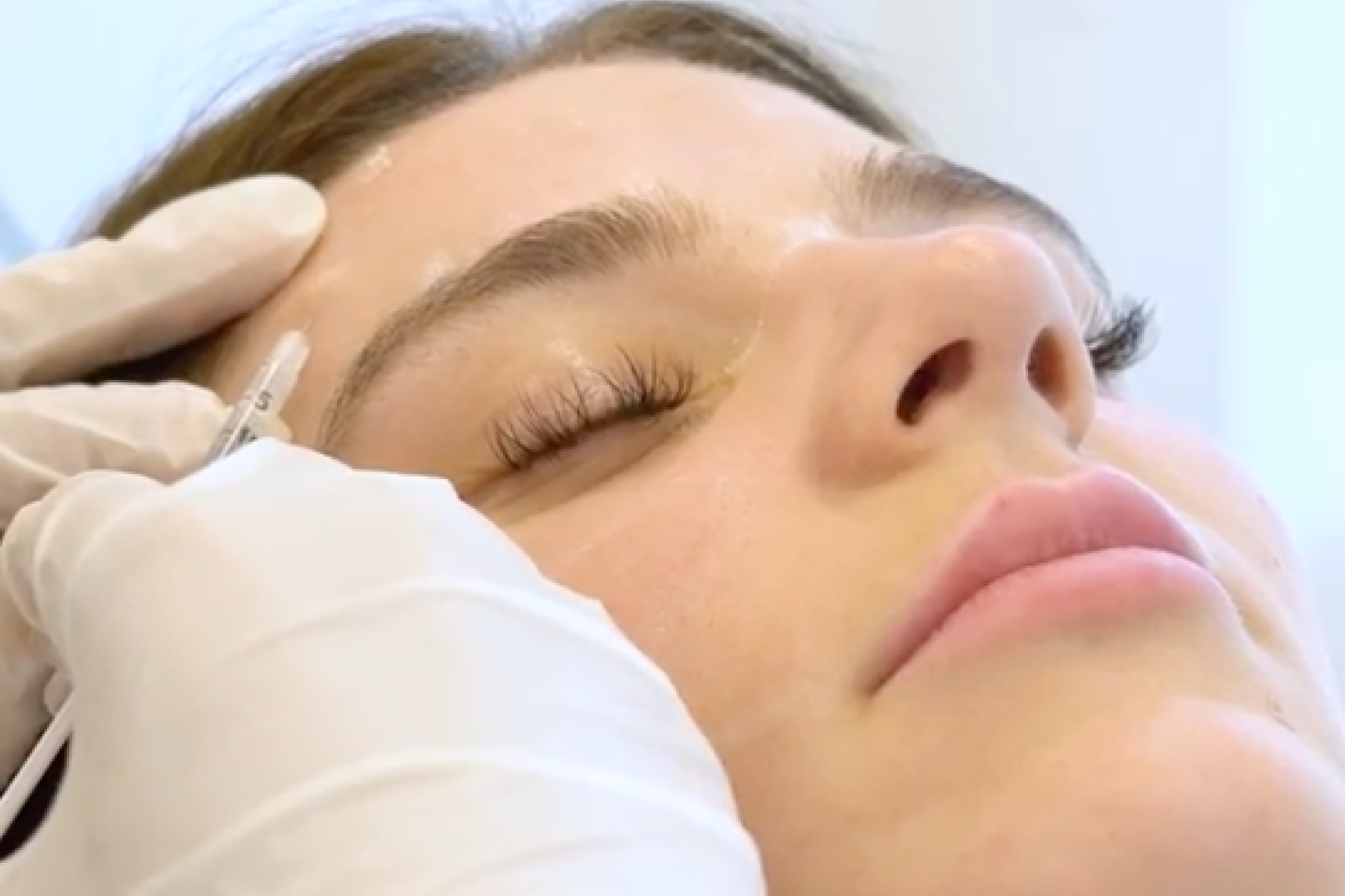 Botox Nürnberg: Glatte Haut ohne Kompromisse
